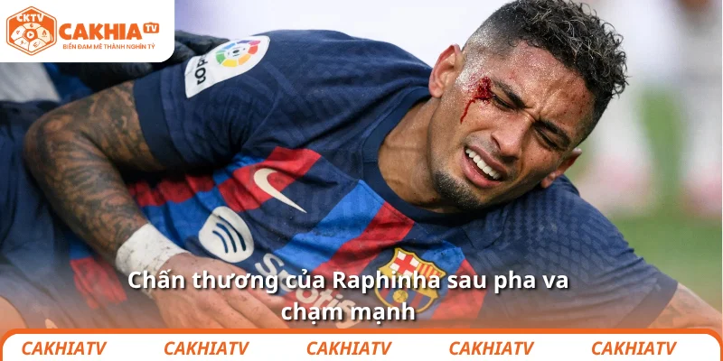 Chủ tịch Barca “đổ lỗi” FIFA vì chấn thương của Raphinha 1 Chấn thương của Raphinha sau pha va chạm mạnh